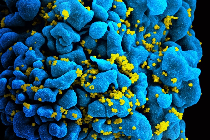 Blue and yellow image of a virus
