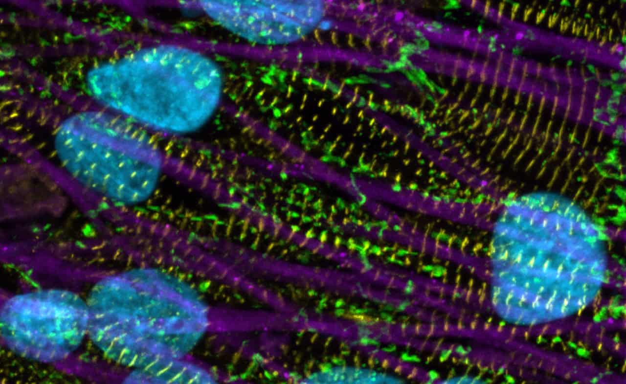 U-M BME Collaboration Sets New Standards in Cardiac Tissue Engineering ...