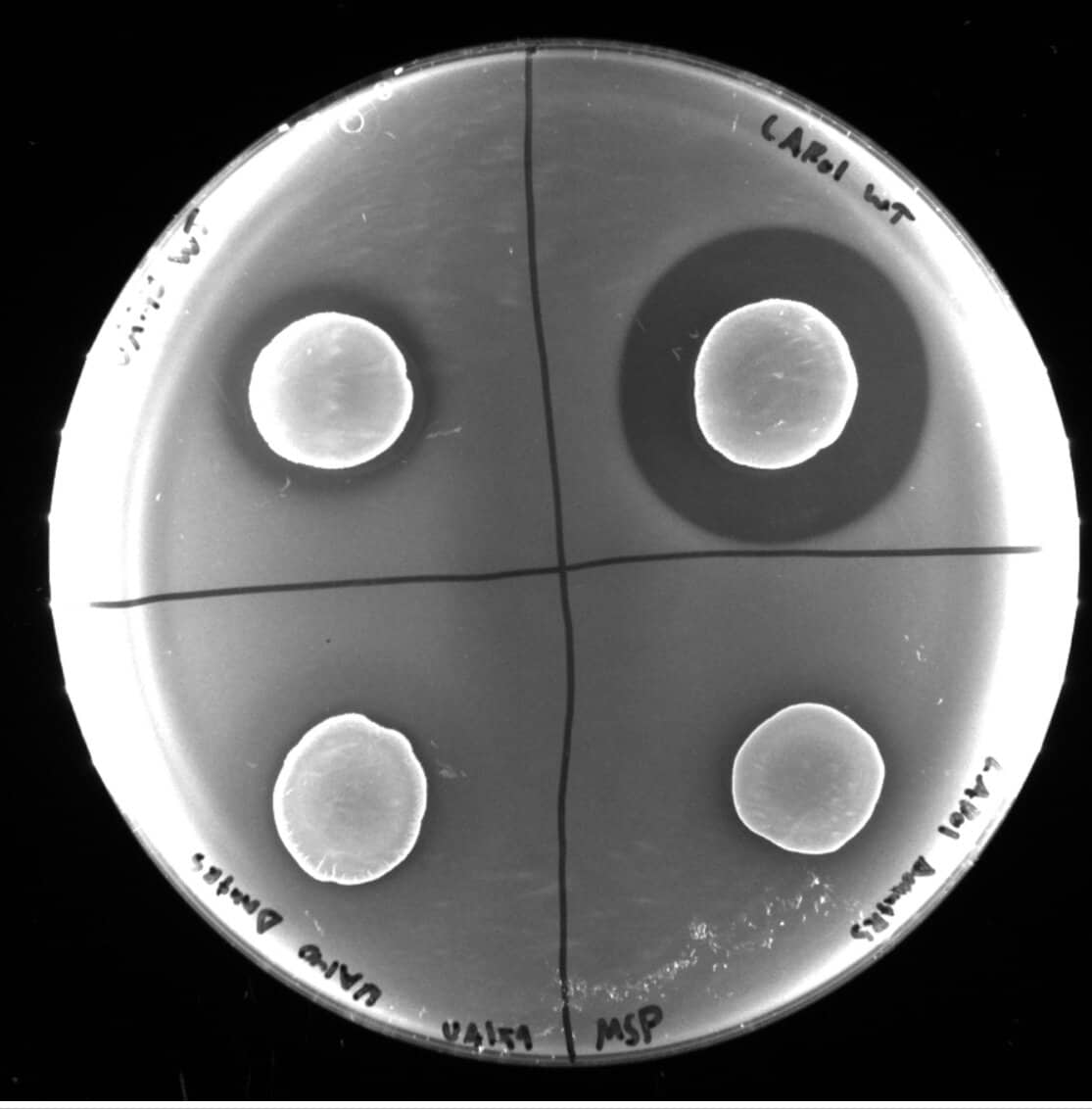 Unlocking the Secrets of the Oral Microbiome To Prevent and Manage Dental Diseases